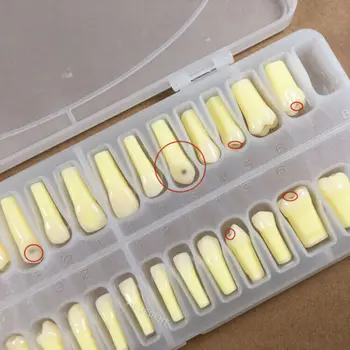 2 коробки Удаление кариеса Разрушенных Зубов Практическая модель Для студентов-стоматологов Тест