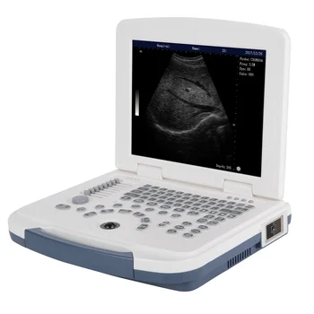 Китай Самый дешевый по цене Медицинский ультразвуковой Диагностический аппарат Портативный портативный ультразвуковой сканер для беременных